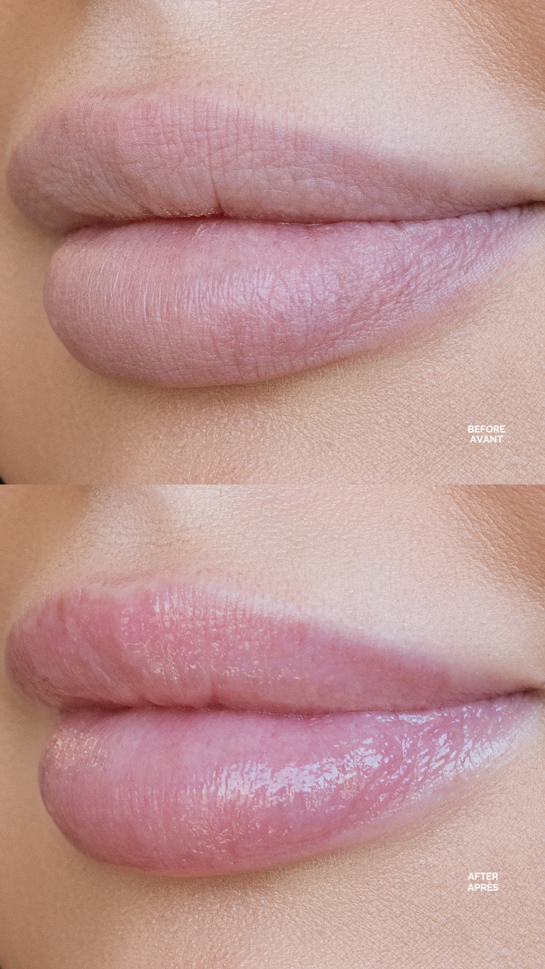 Exfoliant pour les lèvres Clear Kiss